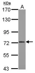 Anti-CPSF73 antibody [N1C1] used in Western Blot (WB). GTX116188