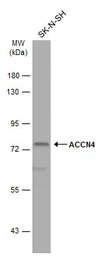 Anti-ACCN4 antibody [N1N3] used in Western Blot (WB). GTX116235