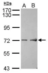 Anti-ACCN4 antibody [N1N3] used in Western Blot (WB). GTX116235