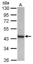 Anti-PAK1 interacting protein 1 antibody [N1C1] used in Western Blot (WB). GTX116276