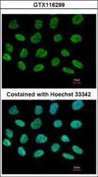 Anti-DIP13B antibody [C2C3], C-term used in Immunocytochemistry/ Immunofluorescence (ICC/IF). GTX116299