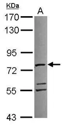Anti-ATAD3A antibody used in Western Blot (WB). GTX116301