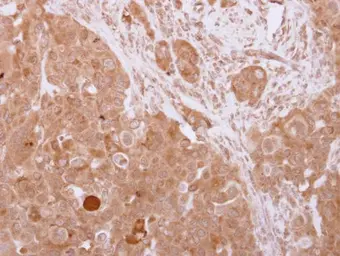 Anti-UBA6 antibody [N1N3] used in IHC (Paraffin sections) (IHC-P). GTX116307