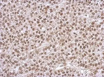 Anti-PHF10 antibody used in IHC (Paraffin sections) (IHC-P). GTX116314