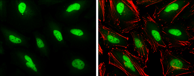 Anti-PHF10 antibody used in Immunocytochemistry/ Immunofluorescence (ICC/IF). GTX116314