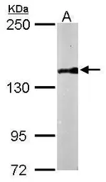 Anti-PDS5B antibody [N1N2], N-term used in Western Blot (WB). GTX116345