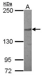 Anti-PDS5B antibody [N1N2], N-term used in Western Blot (WB). GTX116345