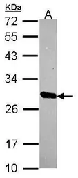 Anti-HscB antibody [N1C3] used in Western Blot (WB). GTX116372