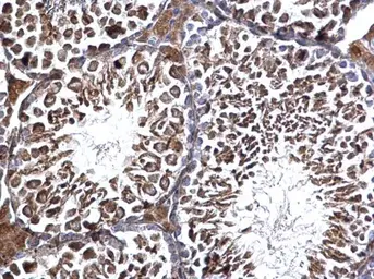 Anti-Edc3 antibody [N2C2], Internal used in IHC (Paraffin sections) (IHC-P). GTX116386