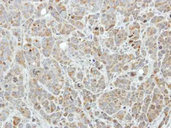 Anti-Edc3 antibody [N2C2], Internal used in IHC (Paraffin sections) (IHC-P). GTX116386