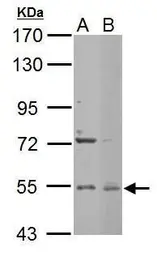 Anti-Edc3 antibody [N2C2], Internal used in Western Blot (WB). GTX116386