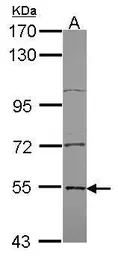 Anti-Edc3 antibody [N2C2], Internal used in Western Blot (WB). GTX116386