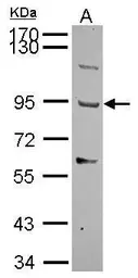 Anti-TMTSP antibody [N3C2], Internal used in Western Blot (WB). GTX116397