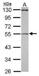 Anti-Pellino 2 antibody [N3C3] used in Western Blot (WB). GTX116399