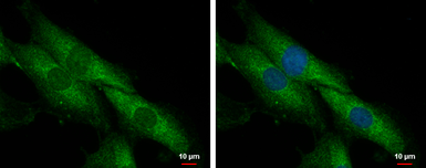 Anti-SLC25A23 antibody used in Immunocytochemistry/ Immunofluorescence (ICC/IF). GTX116402