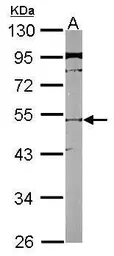 Anti-SLC25A23 antibody used in Western Blot (WB). GTX116402