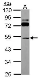 Anti-SLC25A23 antibody used in Western Blot (WB). GTX116402