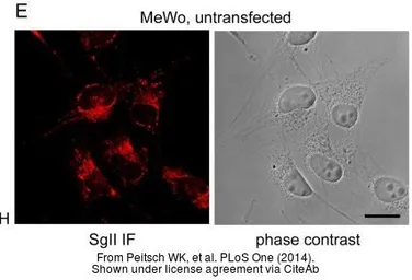 Anti-Chromogranin C antibody used in Immunocytochemistry/ Immunofluorescence (ICC/IF). GTX116446