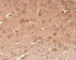 Anti-Chromogranin C antibody used in IHC (Paraffin sections) (IHC-P). GTX116446