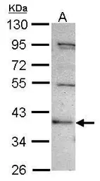 Anti-C2CD2 antibody used in Western Blot (WB). GTX116476