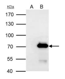 Anti-PRMT3 antibody used in Immunoprecipitation (IP). GTX116478