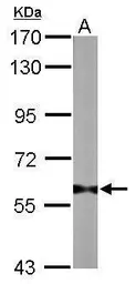 Anti-PRMT3 antibody used in Western Blot (WB). GTX116478