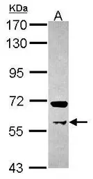 Anti-PRMT3 antibody used in Western Blot (WB). GTX116478