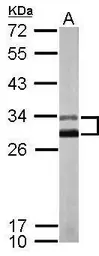 Anti-KChIP2 antibody [N1C3] used in Western Blot (WB). GTX116483