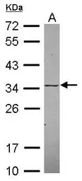 Anti-KChIP2 antibody [N1C3] used in Western Blot (WB). GTX116483