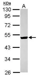 Anti-ILKAP antibody [N2C3] used in Western Blot (WB). GTX116528