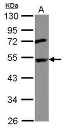 Anti-Deptor antibody [N1C3] used in Western Blot (WB). GTX116540