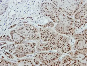 Anti-DNA polymerase epsilon 3 antibody [N1C3] used in IHC (Paraffin sections) (IHC-P). GTX116557