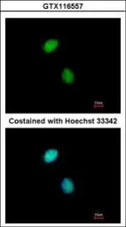 Anti-DNA polymerase epsilon 3 antibody [N1C3] used in Immunocytochemistry/ Immunofluorescence (ICC/IF). GTX116557