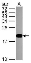 Anti-DNA polymerase epsilon 3 antibody [N1C3] used in Western Blot (WB). GTX116557