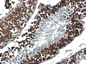 Anti-DDX4 antibody [C1C3] used in IHC (Paraffin sections) (IHC-P). GTX116575