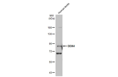 Anti-DDX4 antibody [C1C3] used in Western Blot (WB). GTX116575