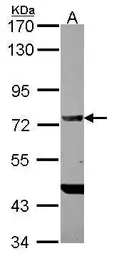 Anti-DDX4 antibody [C1C3] used in Western Blot (WB). GTX116575