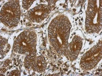 Anti-PHD4 antibody [N2C2], Internal used in IHC (Paraffin sections) (IHC-P). GTX116581