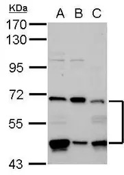 Anti-PHD4 antibody [N2C2], Internal used in Western Blot (WB). GTX116581