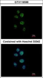 Anti-ZNF83 antibody [N1N2], N-term used in Immunocytochemistry/ Immunofluorescence (ICC/IF). GTX116599