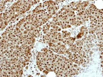 Anti-ZNF83 antibody [N1N2], N-term used in IHC (Paraffin sections) (IHC-P). GTX116599