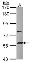 Anti-ZNF83 antibody [N1N2], N-term used in Western Blot (WB). GTX116599