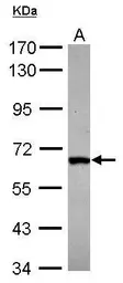 Anti-DDX28 antibody [N2C1], Internal used in Western Blot (WB). GTX116603