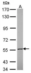 Anti-RNF23 antibody [N2C2], Internal used in Western Blot (WB). GTX116637