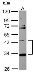 Anti-StARD7 antibody [N1C2] used in Western Blot (WB). GTX116640