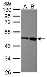 Anti-ZBTB26 antibody [N3C3] used in Western Blot (WB). GTX116694