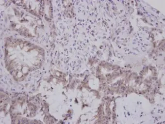 Anti-GBA3 antibody used in IHC (Paraffin sections) (IHC-P). GTX116696