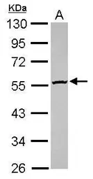 Anti-GBA3 antibody used in Western Blot (WB). GTX116696