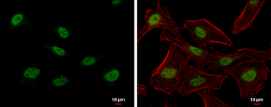 Anti-PTBP2 antibody used in Immunocytochemistry/ Immunofluorescence (ICC/IF). GTX116704