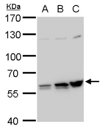 Anti-PTBP2 antibody used in Western Blot (WB). GTX116704